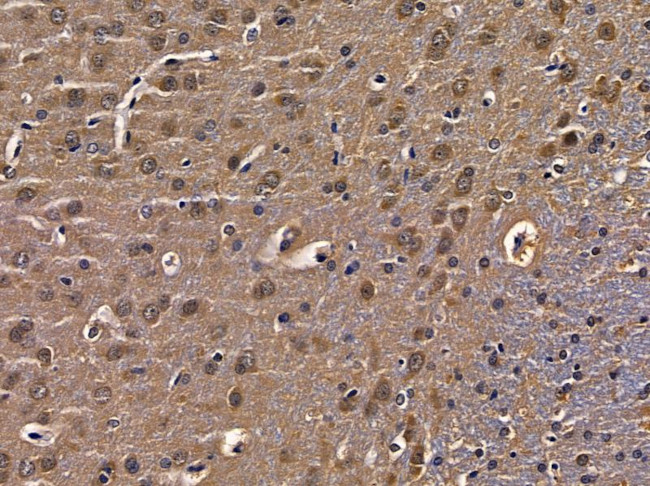 RAB17 Antibody in Immunohistochemistry (Paraffin) (IHC (P))