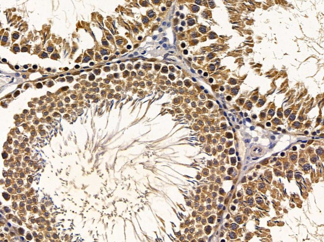 RAB17 Antibody in Immunohistochemistry (Paraffin) (IHC (P))