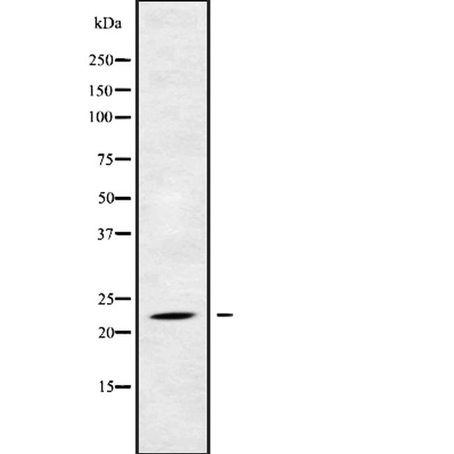 RAB17 Antibody in Western Blot (WB)