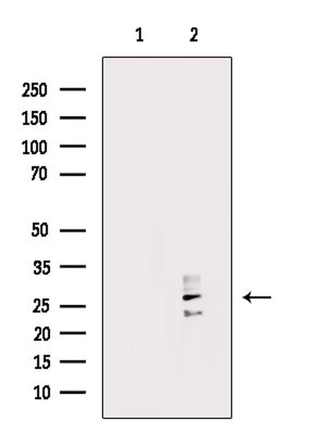 RAB29 Antibody in Western Blot (WB)