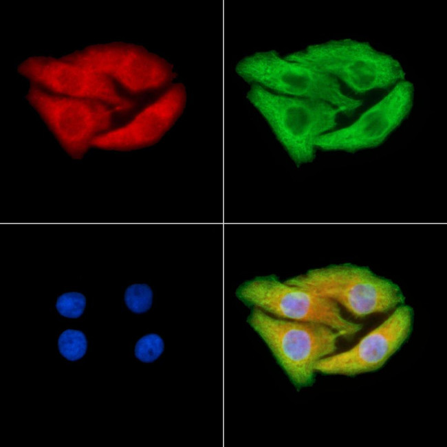 RALB Antibody in Immunocytochemistry (ICC/IF)