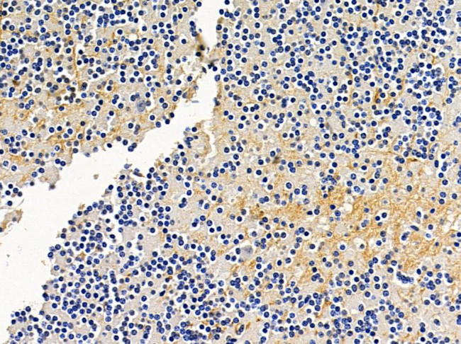 RASGRF2 Antibody in Immunohistochemistry (Paraffin) (IHC (P))