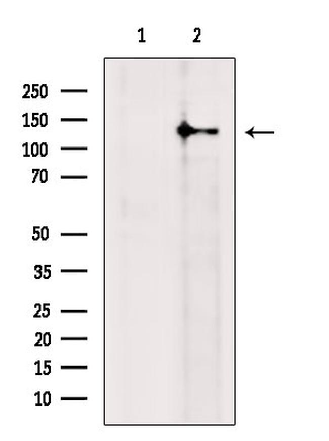 RASGRF2 Antibody in Western Blot (WB)