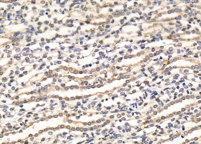 RBPMS Antibody in Immunohistochemistry (Paraffin) (IHC (P))