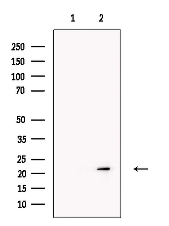 RBPMS Antibody in Western Blot (WB)