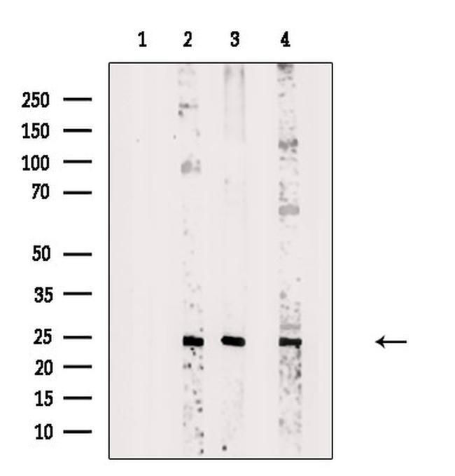 RBPMS Antibody in Western Blot (WB)