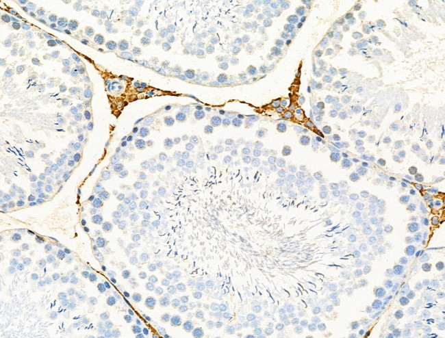 Renin Antibody in Immunohistochemistry (Paraffin) (IHC (P))