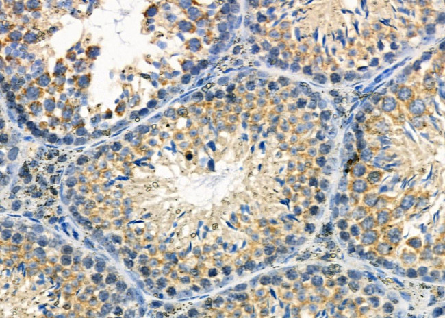 ATP6IP2 Antibody in Immunohistochemistry (Paraffin) (IHC (P))