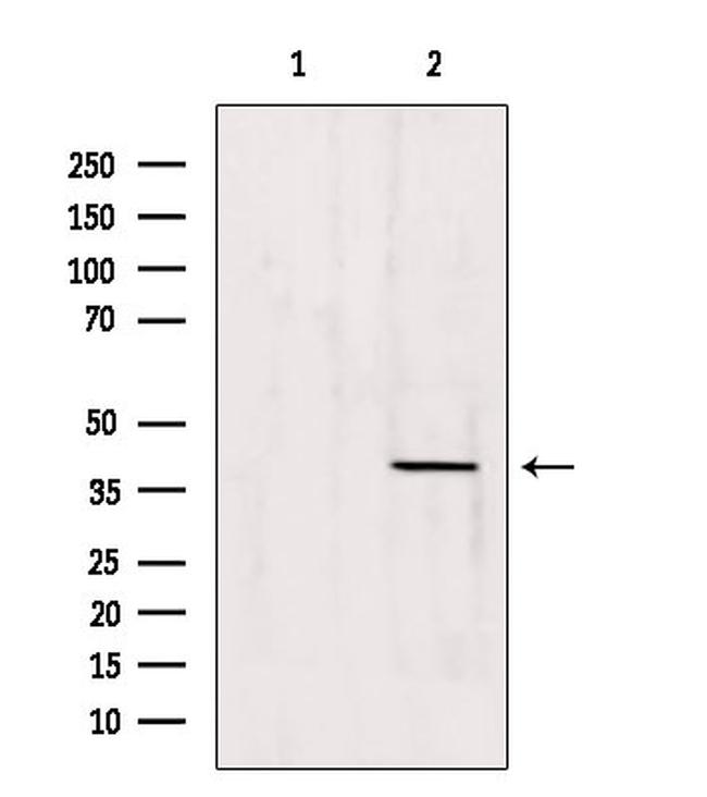 ATP6IP2 Antibody in Western Blot (WB)