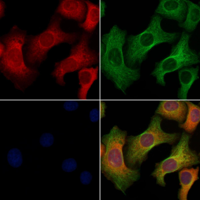 RET Antibody in Immunocytochemistry (ICC/IF)