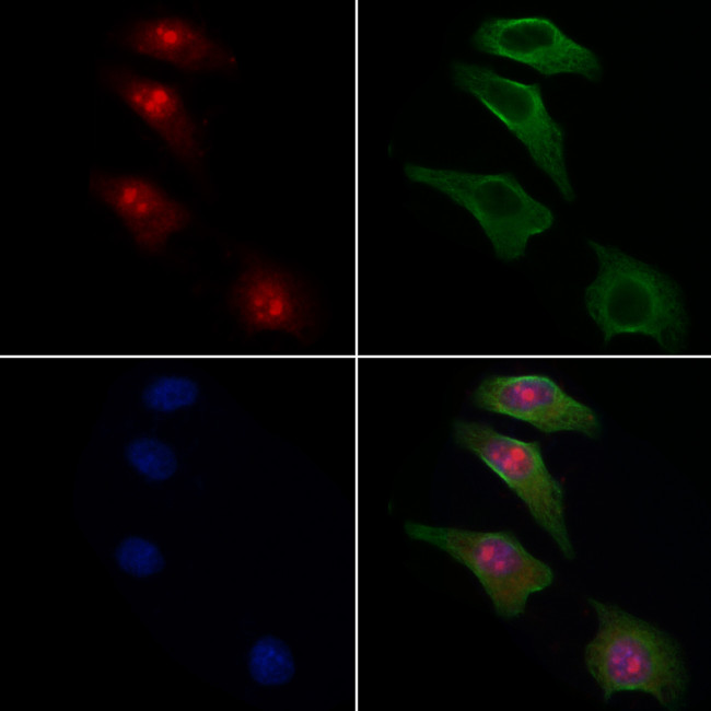 RB1 Antibody in Immunocytochemistry (ICC/IF)