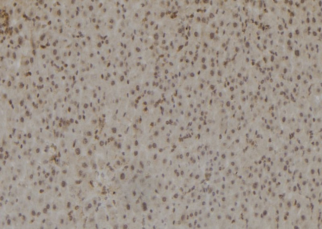 RB1 Antibody in Immunohistochemistry (Paraffin) (IHC (P))