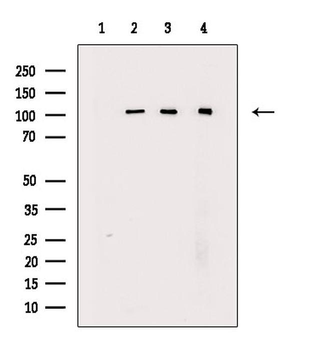 RB1 Antibody in Western Blot (WB)