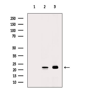 RHOA Antibody in Western Blot (WB)