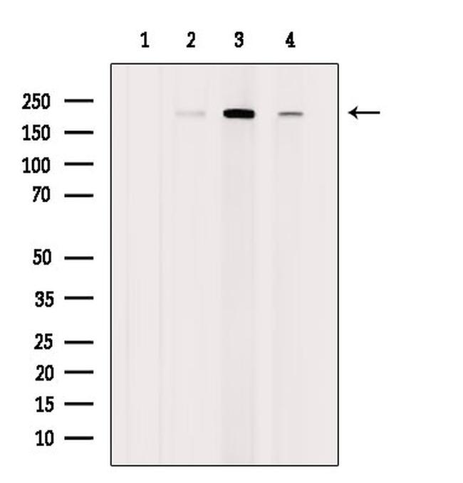 RICTOR Antibody in Western Blot (WB)