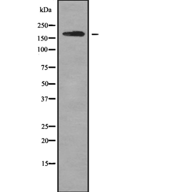 ROBO1 Antibody in Western Blot (WB)