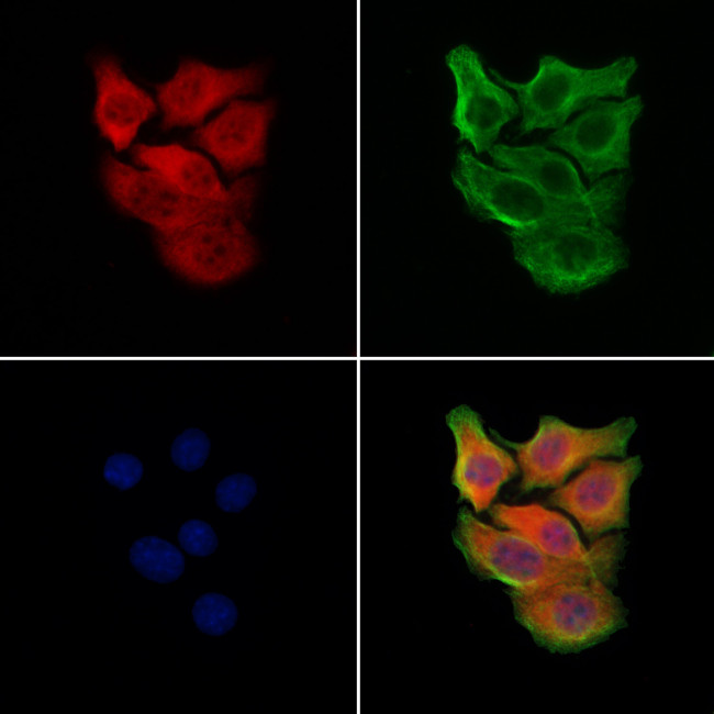 RPE65 Antibody in Immunocytochemistry (ICC/IF)