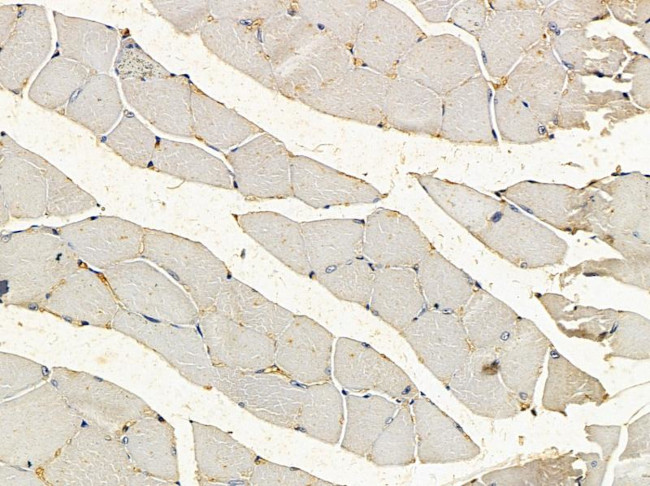 RyR1 Antibody in Immunohistochemistry (Paraffin) (IHC (P))