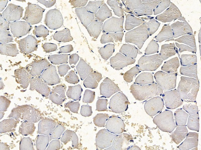 RyR1 Antibody in Immunohistochemistry (Paraffin) (IHC (P))