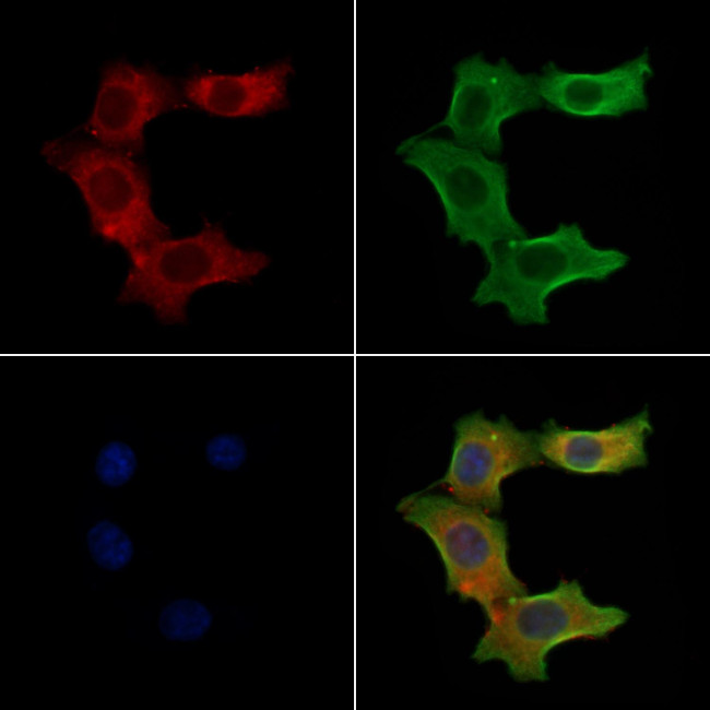 S100A3 Antibody in Immunocytochemistry (ICC/IF)