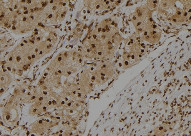 S100A3 Antibody in Immunohistochemistry (Paraffin) (IHC (P))