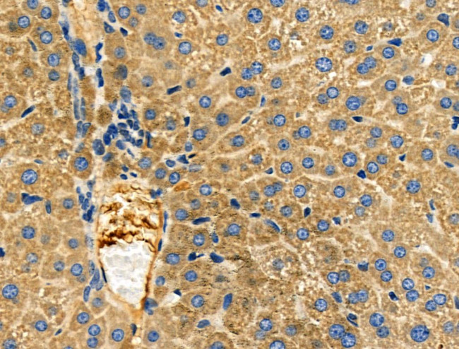 S100 Antibody in Immunohistochemistry (Paraffin) (IHC (P))