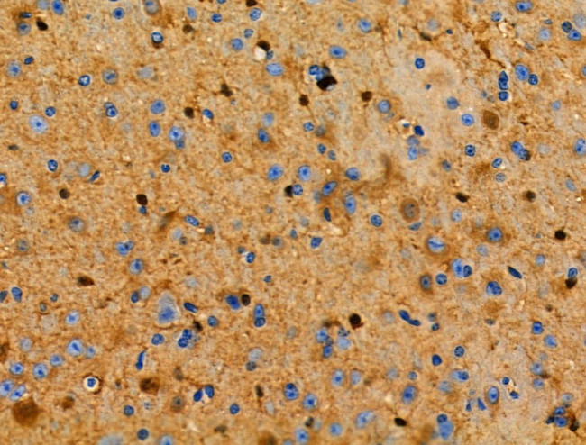 S100 Antibody in Immunohistochemistry (Paraffin) (IHC (P))