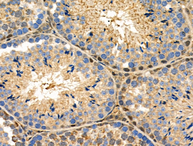 S100 Antibody in Immunohistochemistry (Paraffin) (IHC (P))