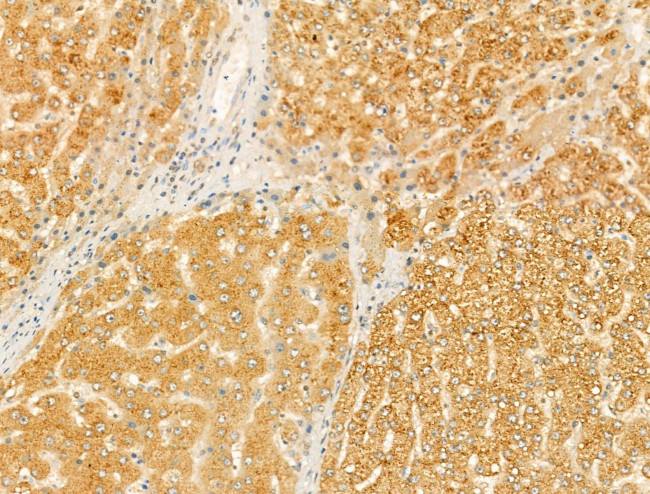 SAA2 Antibody in Immunohistochemistry (Paraffin) (IHC (P))