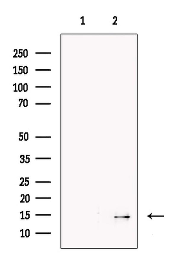 SAA2 Antibody in Western Blot (WB)