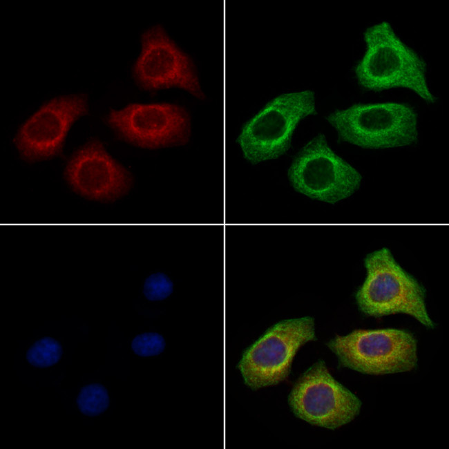 SAA4 Antibody in Immunocytochemistry (ICC/IF)