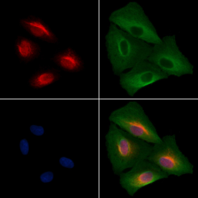 SALL1 Antibody in Immunocytochemistry (ICC/IF)