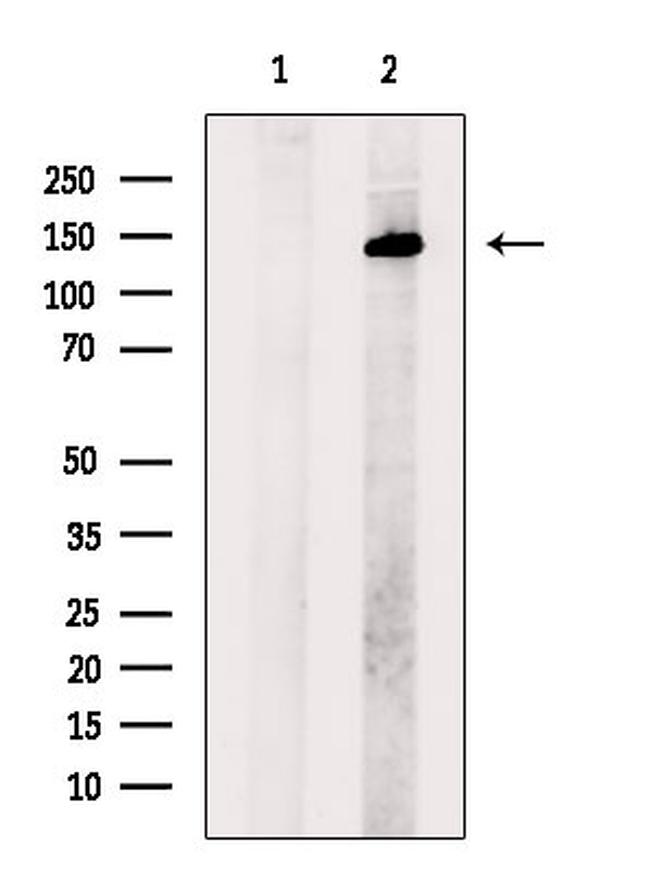 SALL1 Antibody in Western Blot (WB)