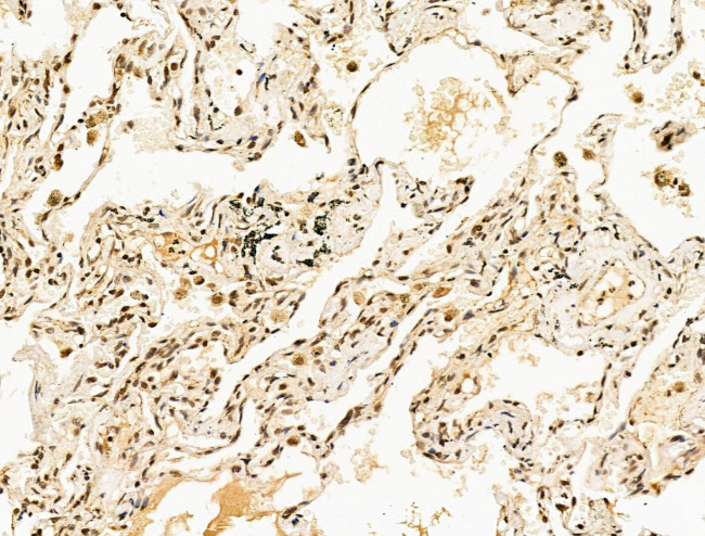 SF3B1 Antibody in Immunohistochemistry (Paraffin) (IHC (P))