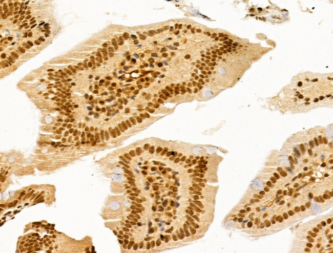 SF3B1 Antibody in Immunohistochemistry (Paraffin) (IHC (P))