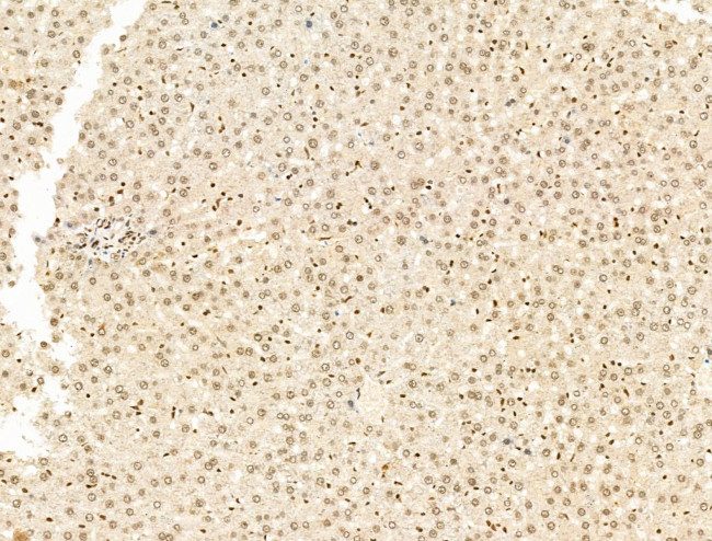 SF3B1 Antibody in Immunohistochemistry (Paraffin) (IHC (P))