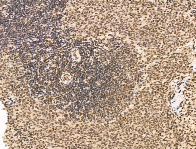 SF3B1 Antibody in Immunohistochemistry (Paraffin) (IHC (P))