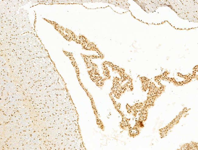 SF3B1 Antibody in Immunohistochemistry (Paraffin) (IHC (P))