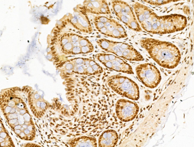 SF3B1 Antibody in Immunohistochemistry (Paraffin) (IHC (P))