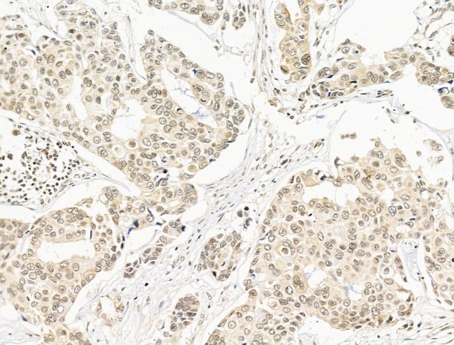 SF3B1 Antibody in Immunohistochemistry (Paraffin) (IHC (P))