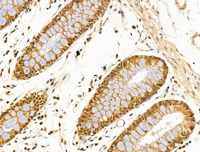 SF3B1 Antibody in Immunohistochemistry (Paraffin) (IHC (P))