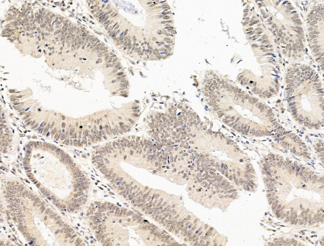 SF3B1 Antibody in Immunohistochemistry (Paraffin) (IHC (P))