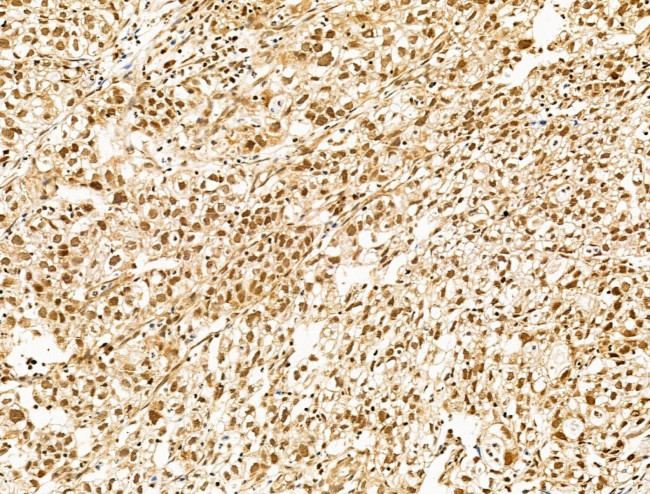 SF3B1 Antibody in Immunohistochemistry (Paraffin) (IHC (P))