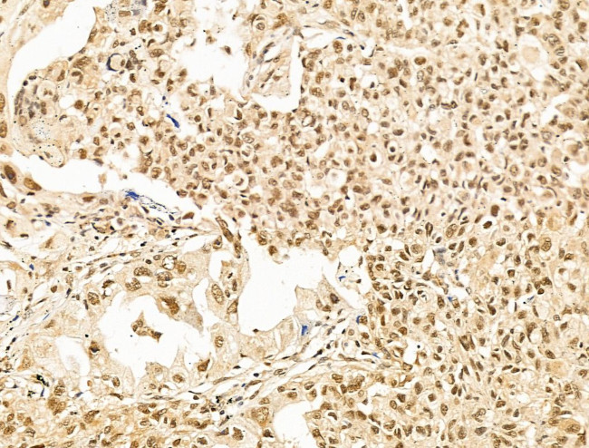 SF3B1 Antibody in Immunohistochemistry (Paraffin) (IHC (P))