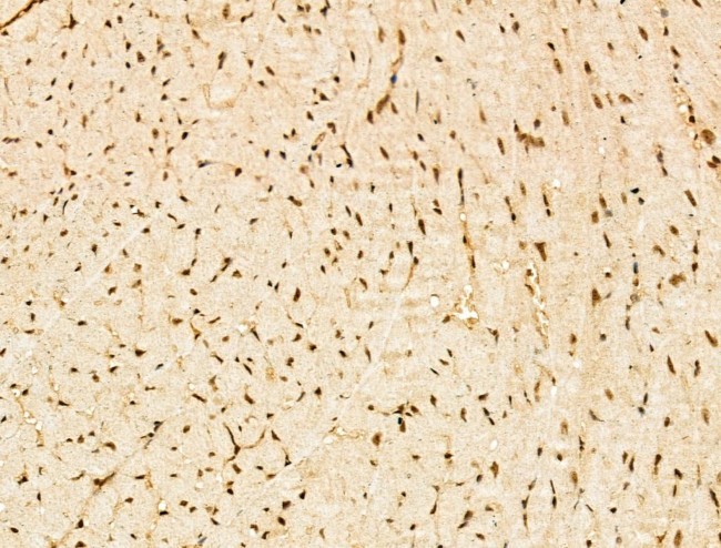 SF3B1 Antibody in Immunohistochemistry (Paraffin) (IHC (P))