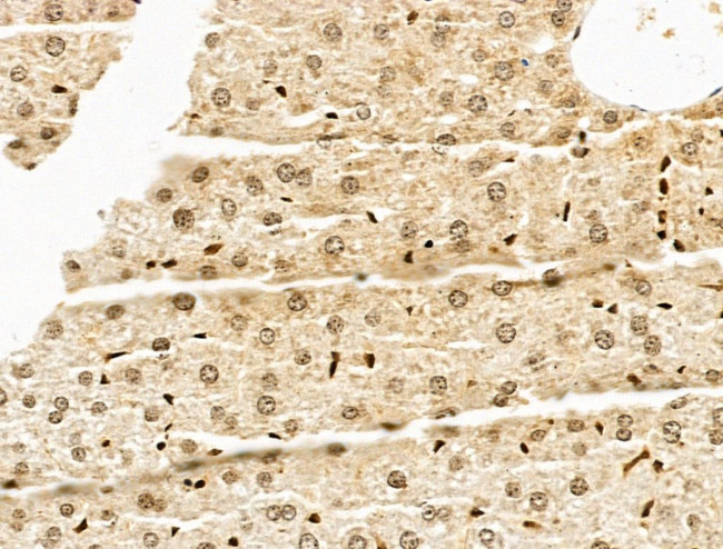 SF3B1 Antibody in Immunohistochemistry (Paraffin) (IHC (P))