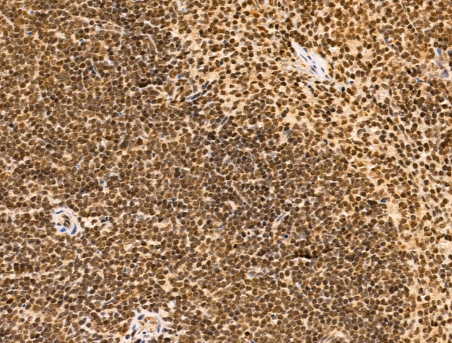 SF3B1 Antibody in Immunohistochemistry (Paraffin) (IHC (P))