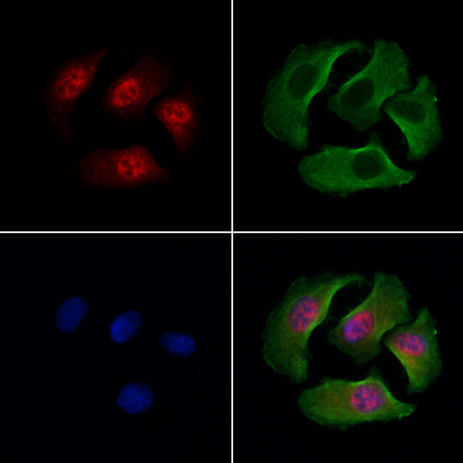 SATB2 Antibody in Immunocytochemistry (ICC/IF)