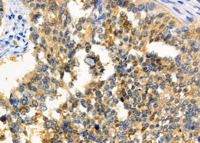 SATB2 Antibody in Immunohistochemistry (Paraffin) (IHC (P))