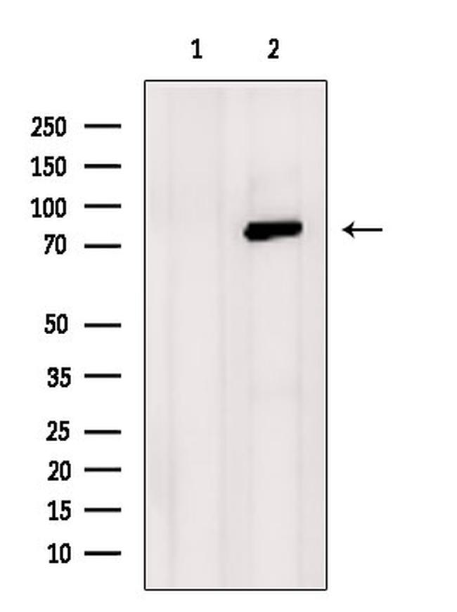 SATB2 Antibody in Western Blot (WB)